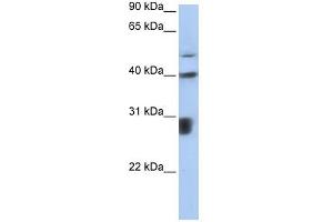 PPIL3 antibody used at 1 ug/ml to detect target protein. (PPIL3 Antikörper)