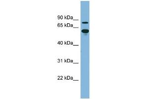 WB Suggested Anti-ABCF2 Antibody Titration:  0. (ABCF2 Antikörper  (N-Term))