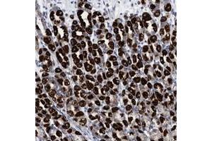 Immunohistochemical staining of human stomach with RSAD1 polyclonal antibody  shows strong cytoplasmic positivity in Parietal cells. (RSAD1 Antikörper)