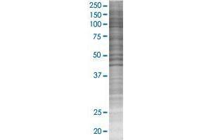 TNFRSF13C 293T Cell Transient Overexpression Lysate(Denatured)
