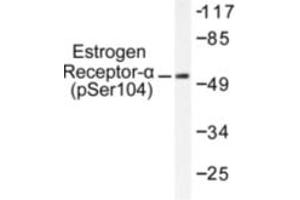 Image no. 2 for anti-Estrogen Receptor 1 (ESR1) (pSer104) antibody (ABIN318016) (Estrogen Receptor alpha Antikörper  (pSer104))