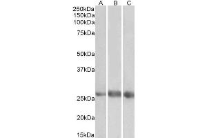 ABIN5539720 (1µg/ml) staining of Heart (A), Kidney (B) and Lung (C) lysates (35µg protein in RIPA buffer). (EGFL7 Antikörper  (Internal Region))