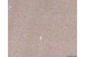 IHC analysis of Tau/MAPT using anti-Tau/MAPT antibody (ABIN7599268).