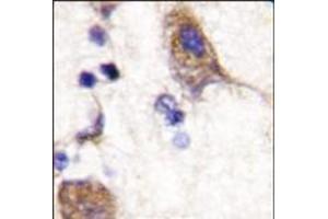 Formalin-fixed and paraffin-embedded human brain tissue reacted with SCYL2 (C-term), which was peroxidase-conjugated to the secondary antibody, followed by DAB staining. (SCYL2 Antikörper  (C-Term))