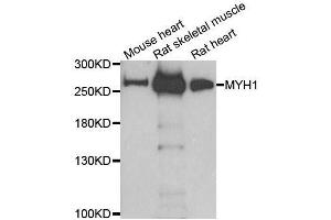Western blot analysis of extracts of various cell lines, using MYH1 antibody. (MYH1 Antikörper  (AA 1-100))