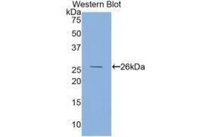 Western blot analysis of the recombinant protein. (FOLR1 Antikörper  (AA 26-229))