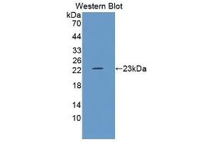 Western Blotting (WB) image for anti-Growth Arrest and DNA-Damage-Inducible, alpha (GADD45A) (AA 1-165) antibody (ABIN1868086) (GADD45A Antikörper  (AA 1-165))