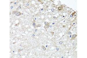 Immunohistochemistry of paraffin-embedded Rat brain using METTL13 Polyclonal Antibody at dilution of 1:100 (40x lens).