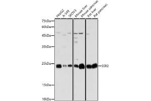 Western blot analysis of extracts of various cell lines, using SSR2 antibody (ABIN7270299) at 1:1000 dilution. (SSR2 Antikörper)