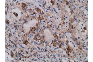 Immunohistochemical staining of paraffin-embedded Human liver tissue using anti-SDR9C7 mouse monoclonal antibody. (SDR9C7 Antikörper)