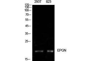 Western Blot (WB) analysis of 293T, 823 cells using Epigen Polyclonal Antibody. (Epigen Antikörper  (Internal Region))