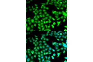 Immunofluorescence analysis of HeLa cells using FOSL1 antibody (ABIN5973108). (FOSL1 Antikörper)