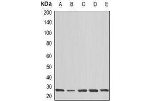 Western blot analysis of COX2 expression in Hela (A), MCF7 (B), Jurkat (C), mouse brain (D), rat brain (E) whole cell lysates. (COX2 Antikörper)
