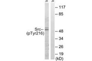 Western blot analysis of extracts from Jurkat cells treated with EGF 200ng/ml 5', using Src (Phospho-Tyr216) Antibody. (Src Antikörper  (pTyr216))