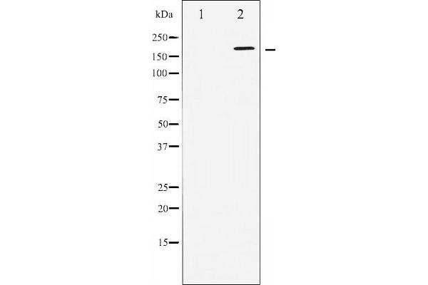 WNK1 Antikörper  (N-Term)