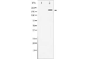 Western blot analysis of WNK1 expression in EGF treated 293 whole cell lysates,The lane on the left is treated with the antigen-specific peptide. (WNK1 Antikörper  (N-Term))