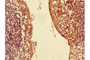 Immunohistochemistry of paraffin-embedded human tonsil tissue using ABIN7146133 at dilution of 1:100 (CXCL3 Antikörper  (AA 35-107))