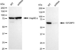 Western blotting analysis using IGF2BP3 antibody (ABIN7799052). (Rekombinanter IGF2BP3 Antikörper)