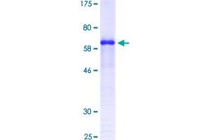 Image no. 1 for Syndecan 1 (SDC1) (AA 23-254) protein (GST tag) (ABIN1319337)
