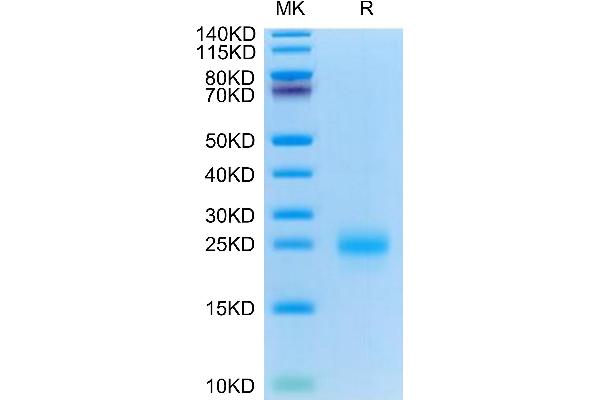 CD69 Protein (CD69) (AA 62-199) (His tag)