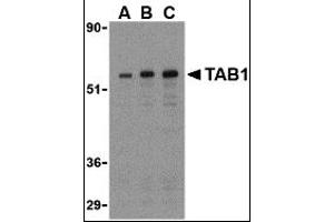 Western Blotting (WB) image for anti-TGF-beta Activated Kinase 1/MAP3K7 Binding Protein 1 (TAB1) (Middle Region) antibody (ABIN1031115) (TAB1 Antikörper  (Middle Region))