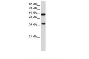 Image no. 1 for anti-AT Rich Interactive Domain 3B (BRIGHT-Like) (ARID3B) (C-Term) antibody (ABIN6736169) (ARID3B Antikörper  (C-Term))