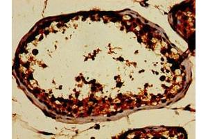 Immunohistochemistry of paraffin-embedded human testis tissue using ABIN7162483 at dilution of 1:100 (SIN3A Antikörper  (AA 1-123))