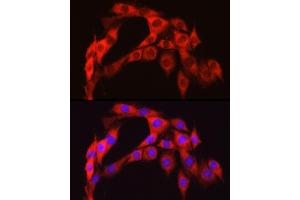 Immunofluorescence analysis of PC-12 cells using S6 Ribosomal Protein (RPS6) Rabbit pAb (ABIN6133901, ABIN6147227, ABIN6147228 and ABIN6221687) at dilution of 1:100 (40x lens). (RPS6 Antikörper  (AA 1-100))