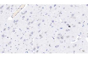 Detection of GRIN2B in Human Cerebrum Tissue using Monoclonal Antibody to Glutamate Receptor, Ionotropic, N-Methyl-D-Aspartate 2B (GRIN2B)