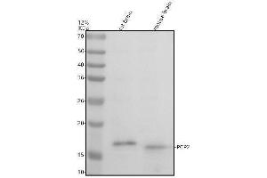 Western blot analysis of PCP2 using anti-PCP2 antibody (ABIN7825756).