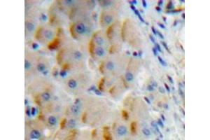 Used in DAB staining on fromalin fixed paraffin-embedded Liver tissue (Insulin Receptor Antikörper  (AA 1027-1364))