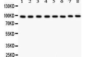 Anti- TFRC antibody, Western blotting All lanes: Anti TRFC  at 0. (Transferrin Receptor Antikörper  (AA 1-198))