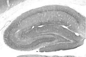 Adult rat hippocampus immunohistochemistry. (DLX1 Antikörper  (AA 53-74))
