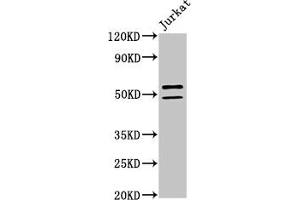 Western Blot Positive WB detected in: Jurkat whole cell lysate All lanes: NOVA1 antibody at 2 μg/mL Secondary Goat polyclonal to rabbit IgG at 1/50000 dilution Predicted band size: 53, 20, 50, 52 kDa Observed band size: 53, 50 kDa