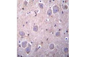 Formalin fixed, paraffin embedded human brain tissue stained with RAP1GDS1 Antibody  followed by peroxidase conjugation of the secondary antibody and DAB staining. (RAP1GDS1 Antikörper  (Middle Region))