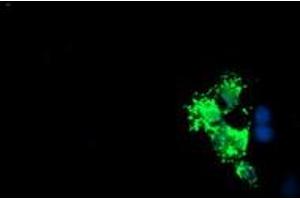Anti-LCMT1 mouse monoclonal antibody (ABIN2454745) immunofluorescent staining of COS7 cells transiently transfected by pCMV6-ENTRY LCMT1 (RC200018). (LCMT1 Antikörper)