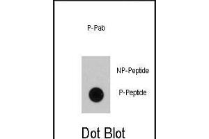 Dot blot analysis of anti-RAF1 Phospho-specific Pab (ABIN389895 and ABIN2839736) on nitrocellulose membrane. (RAF1 Antikörper  (pSer339))