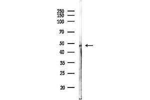 Western blot analysis of lysates from MCF7 cells(heat-shock,45 min treatment), using SGK1 Antibody at 1/1000 dilution.
