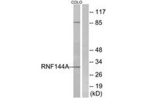 Western blot analysis of extracts from COLO cells, using RNF144A Antibody.