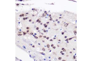 Immunohistochemistry (IHC) image for anti-CUGBP, Elav-Like Family Member 1 (CELF1) (AA 108-483) antibody (ABIN6138399)