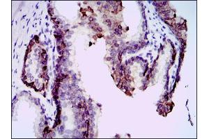 Immunohistochemical analysis of paraffin-embedded kidney tissues using mouse Splunc2 antibody with DAB staining. (BPIFA2 Antikörper)