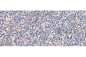 Immunohistochemistry of paraffin-embedded Human tonsil tissue using INSM2 Polyclonal Antibody at dilution of 1:35(x200) (INSM2 Antikörper)