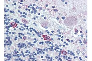 Brain, cerebellum, Human: Formalin-Fixed, Paraffin-Embedded (FFPE) (PDIA4 Antikörper  (AA 623-638))