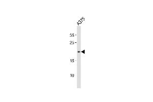 Anti-CDKN2A Antibody (S8)at 1:500 dilution +  whole cell lysates Lysates/proteins at 20 μg per lane.
