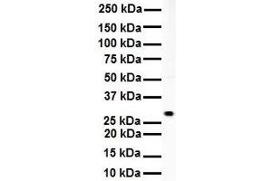 WB Suggested Anti-RNF2 antibody Titration: 1 ug/mL Sample Type: Human Daudi