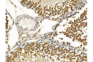 ABIN6264808 and ABIN6276442 at 1/100 staining Rat testis tissue by IHC-P.