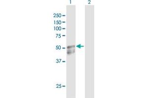 Western Blot analysis of GAL3ST1 expression in transfected 293T cell line by GAL3ST1 MaxPab polyclonal antibody. (GAL3ST1 Antikörper  (AA 1-423))