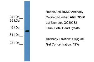 WB Suggested Anti-BSND  Antibody Titration: 0. (BSND Antikörper  (Middle Region))