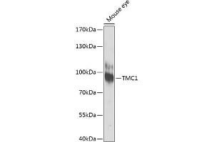 Western blot analysis of extracts of mouse eye, using TMC1 antibody (ABIN6134923, ABIN6149240, ABIN6149242 and ABIN6224704) at 1:1000 dilution. (TMC1 Antikörper  (AA 600-700))
