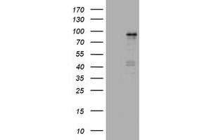Image no. 1 for anti-Nibrin (NBN) (AA 461-754) antibody (ABIN1491541) (Nibrin Antikörper  (AA 461-754))